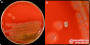 <p><strong>Fig. 81:1.</strong> Kolonier av <i>Vibrio</i> <i>cholerae</i>, odlad aerobt på nötblodagar vid 37 °C. Bild A visar hela plattan och bild B visar en delförstoring. Datum: 2025-08-30.</p>