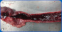<p><strong>Fig. 29:5. </strong> Hemorrhagic enteritis in a dog associated with <em data-end="508" data-start="483">Clostridium perfringens</em> infection.  Images from autopsy at the section of Pathology, HBIO, SLU. </p>