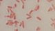 <p><strong>Fig. 142:3. </strong>Gram staining of <i>Citrobacter freundii</i>.</p>

<p> </p>