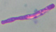 <p><b>Fig. 11:2.</b> Capsule staining with methylene blue of <i>Bacillus anthracis</i> from <b>from the outbreak of anthrax in Halland (Sweden) in December, 2008</b>. The bacteria were first cultivated on blood agar and then in horse serum during 6 h.</p>

<p> </p>