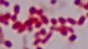 <p><strong>Fig. 106:3. </strong>Gram staining of <i>Actinobacillus lignieresii</i>, strain B10375/10. The length of the scale bar corresponds to 5 µm. Date: 2010-04-23.</p>

<p> </p>