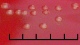 <p><b>Fig. 2.</b> Close up of colonies of <i>Erysipelothrix rhusiopathiae</i>, strain CCUG 221<sup>T</sup>, cultivated aerobically during 24 h on horse blood agar at 37°C in the presence of 5% CO<sub>2</sub>. The total length of the scale bar corresponds to 5 mm. Date: 2010-06-03.</p>

<p> </p>