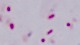 <p><b>Fig. 60:7.</b> Gram staining of <i>Mannheimia haemolytica</i>, strain PAT 4483/10. The length of the scale bar corresponds to 5 µm. Date: 2010-10-06.</p>

<p> </p>