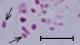 <p><b>Fig. 60:8.</b> Gram staining of <i>Mannheimia haemolytica</i>, strain PAT 4483/10. The bacteria at the arrows are probably dividing. The length of the scale bar corresponds to 5 µm. Date: 2010-10-06.</p>

<p> </p>