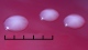 <b>Fig 156:2.</b> Close-up of colonies of <i>Klebsiella oxytoca</i>, strain CCUG 15717, cultivated aerobically on horse blood agar at 37°C during 24 h. A, Photographed with lighting from above. The total length of the scale bar is equivalent to 5 mm. Date: 2011-06-26. <p>