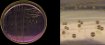 <p><strong>Fig. 194:3.</strong> Colonies of <i>Brucella canis</i>, strain BKT 41247/11, cultivated on purple agar with lactose. A, overwiew of the agar plate where the length of the scale bar is equivalent to 1 cm. B, close-up of colonies where the total length of the scale bar is equivalent to 5 mm. Date: 2011-10-05.</p>