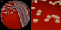 <p><strong>Fig. 23:1.</strong> Colonies of <i>Staphylococcus hyicus</i> cultivated on bovine blood agar during 24 h at 37°C. The plate is photographed under light from above. A, the whole plate. B, close-up of A. The total lengths of the scale bars are equivalent to 1 cm and 5 mm, respectively. Date: 2014-10-24.</p>

<p> </p>