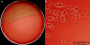 <strong>Fig. 226:2.</strong> Colonies of <i>Staphylococcus schleiferi</i> subsp. <i>schleiferi</i>, strain CCUG 64084, cultivated aerobically on bovine blood agar during 24 h at 37°C. The lighting was primarily from below and the hemolysis is, therefore, cleraly visible (c.f. Fig. 226:1). A, overview of the agarplate. B, close-up of colonies. Date: 2015-12-04.</p>