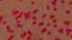 Bordetella pertussis