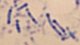 Dichelobacter nodosus